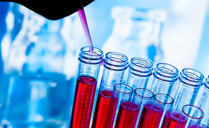Lab samples